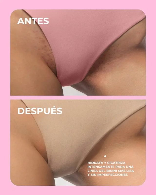 Óleo aromático pós-depilação